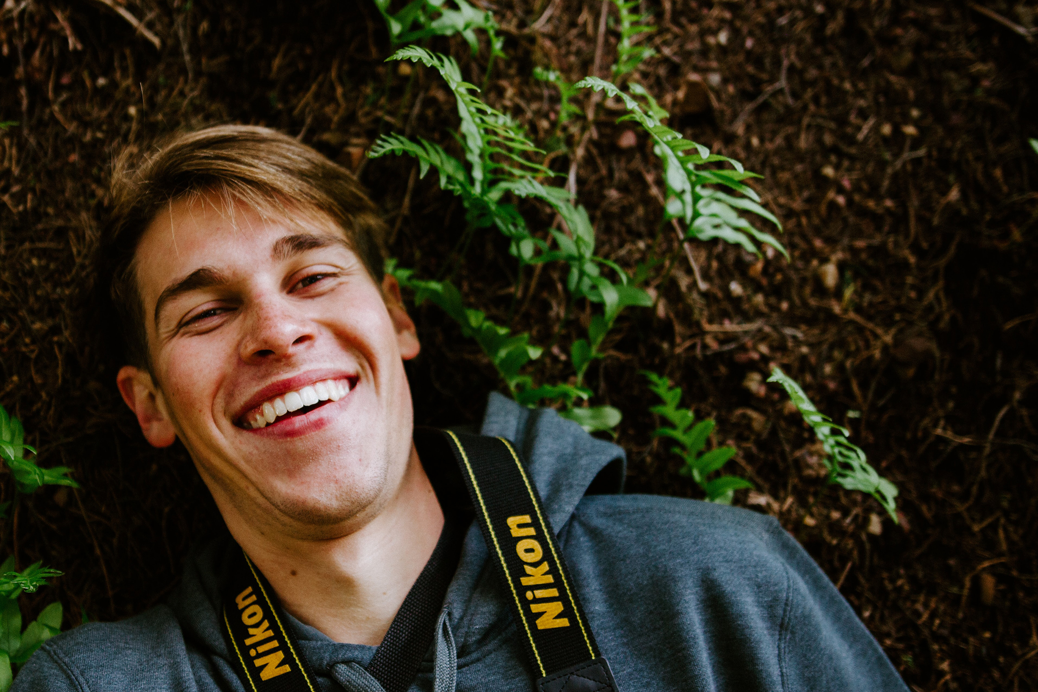 Full mouth composite veneers result