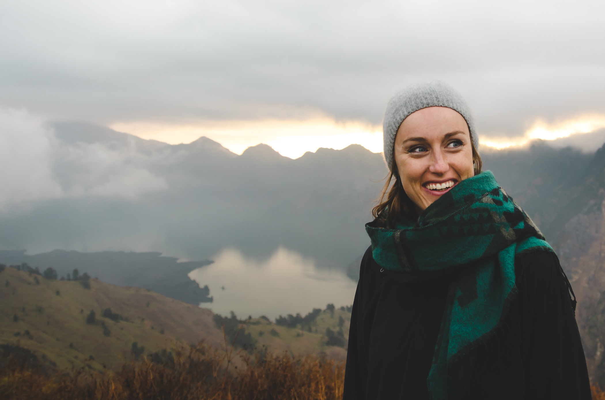 Full mouth crowns before and after — Dental Excellence