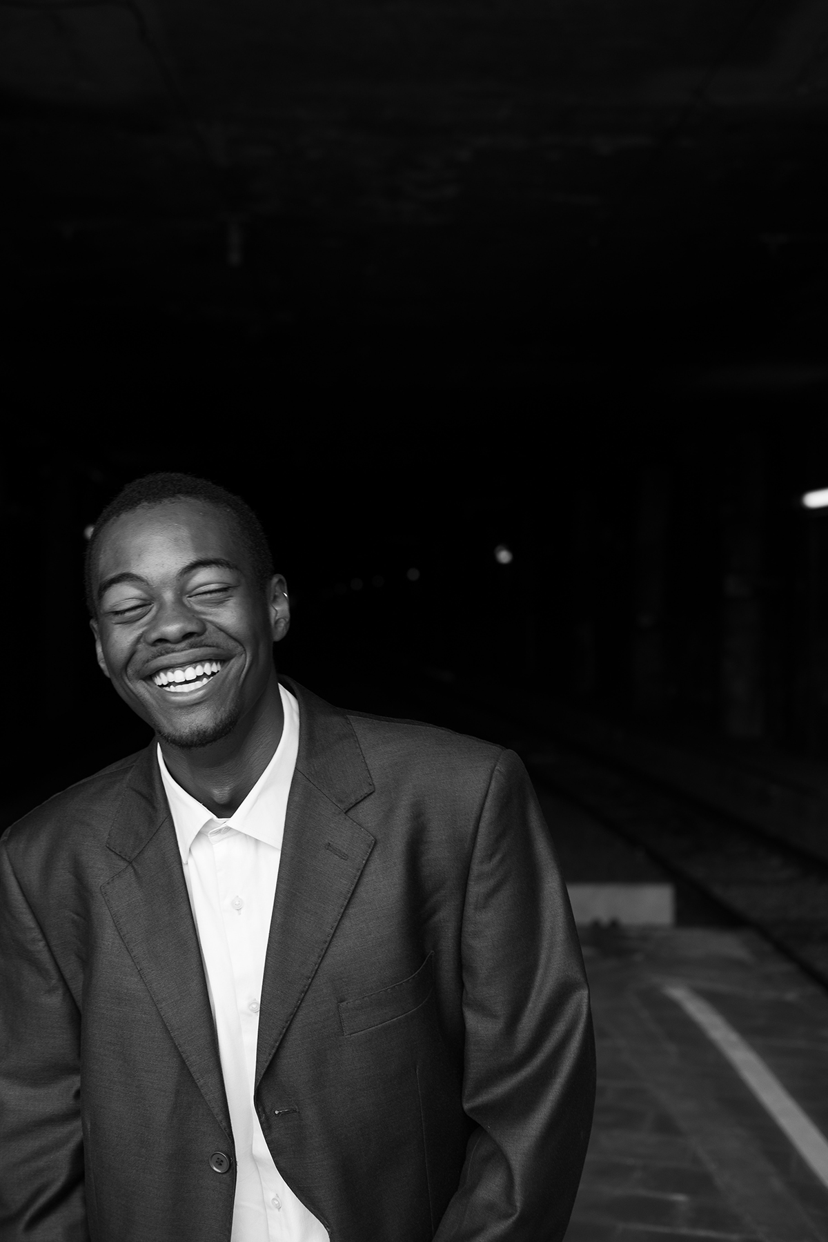 Lumineers vs traditional veneers comparison — real case