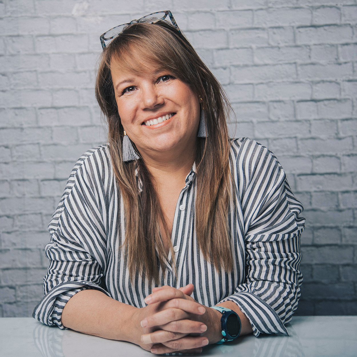 Full arch dental implant restoration result