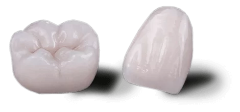 eMax porcelain dental crown — premium ceramic restoration