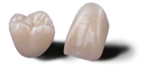 Zirconia dental crown — durable, natural-looking restoration